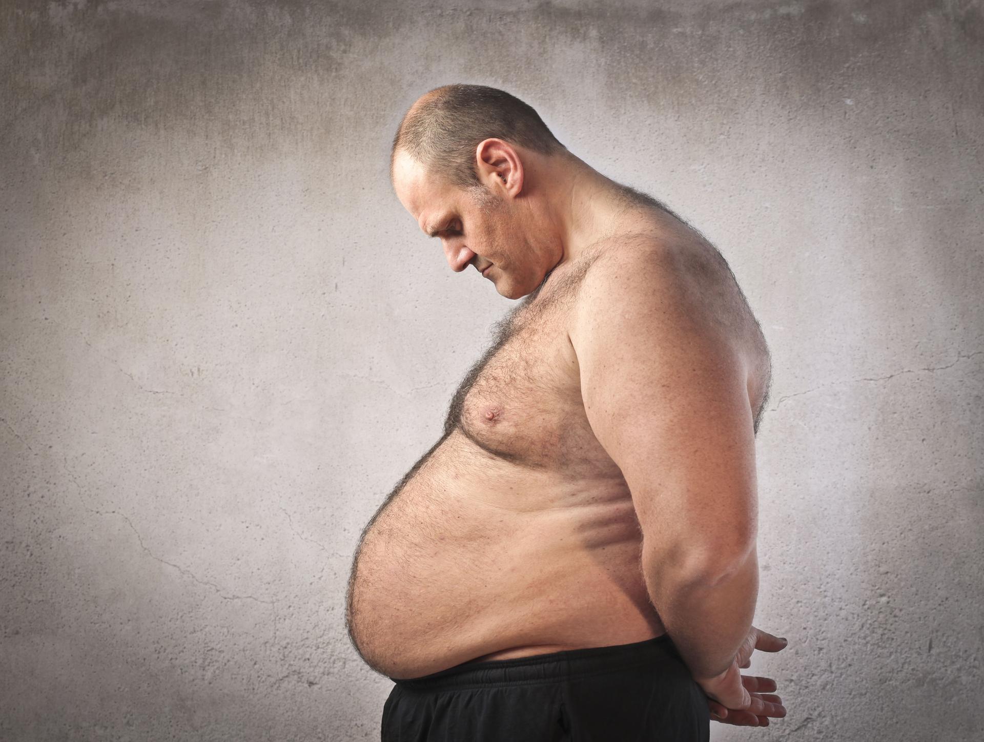 Overweight